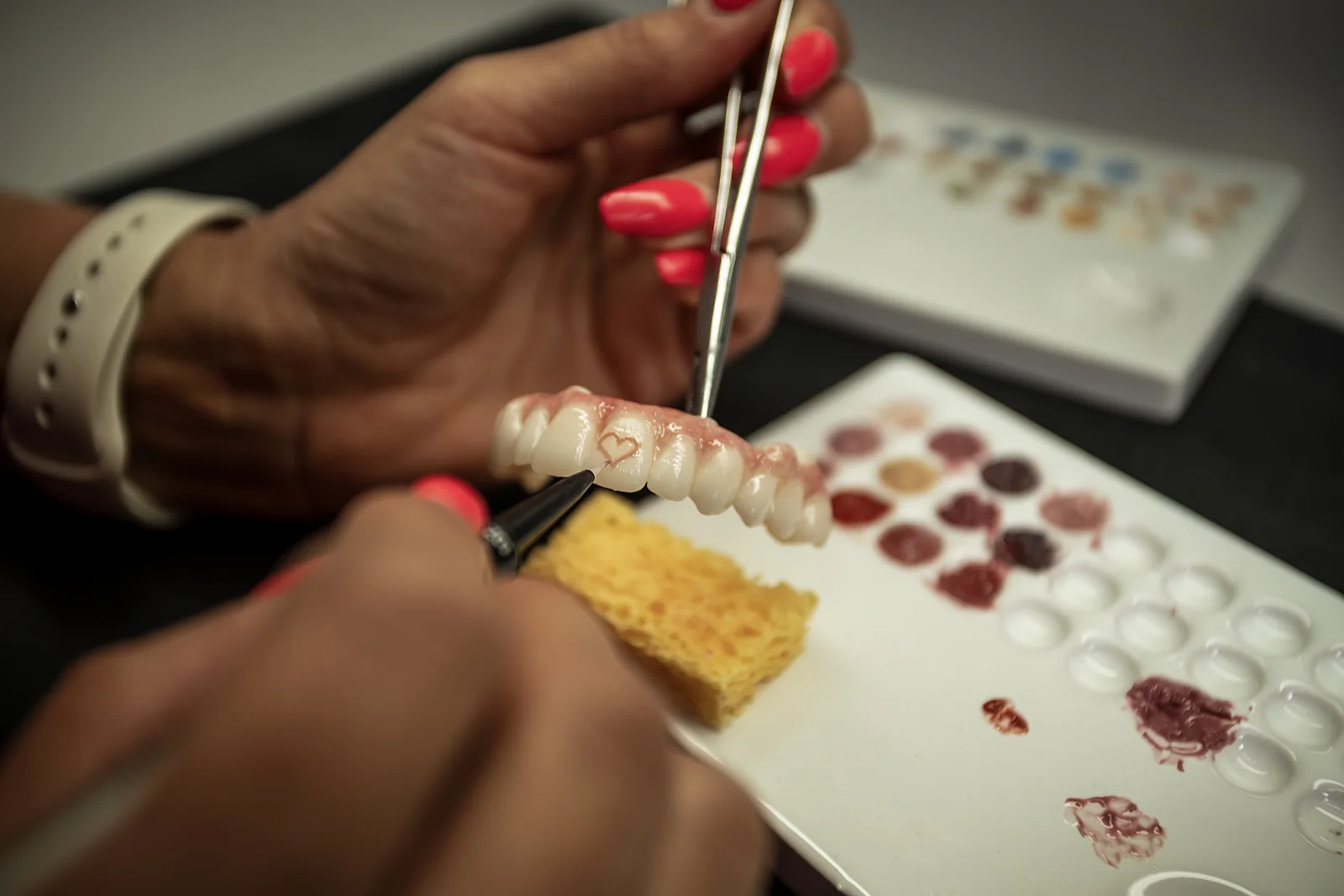 Individuelle Charakterisierung einer dentalen Restauration