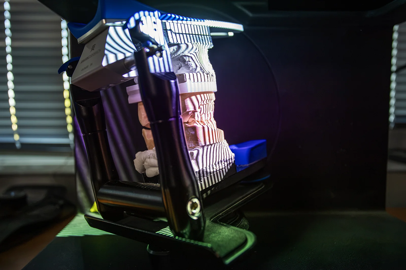 Optischer Scan eines digitalen zahntechnischen Modells