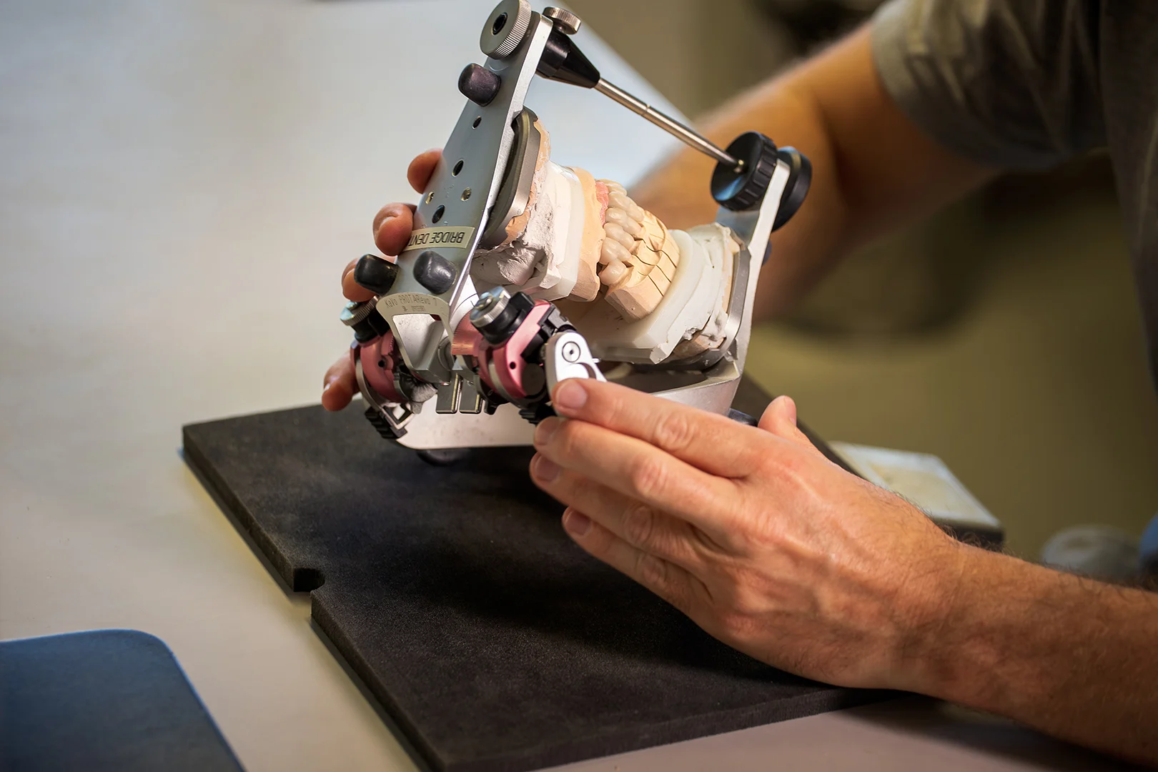 Kontrolle einer hochwertigen Dentalrestauration im Artikulator